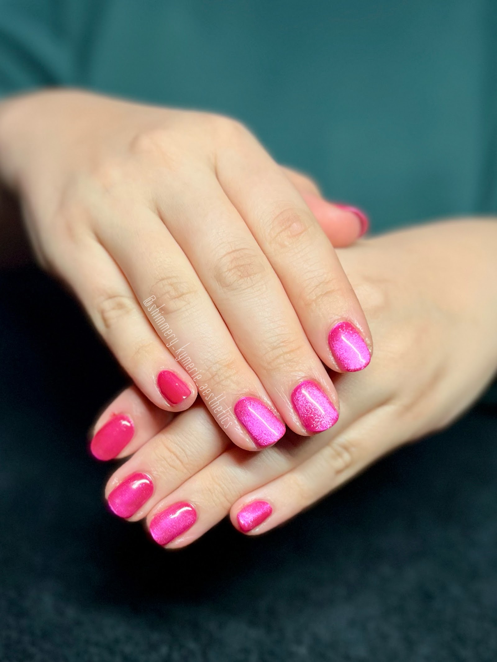 Shimmery Kymerie Aesthetics LLC nail photo 5